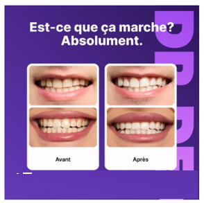 Bandes Blanchiment Dentaire (box3)